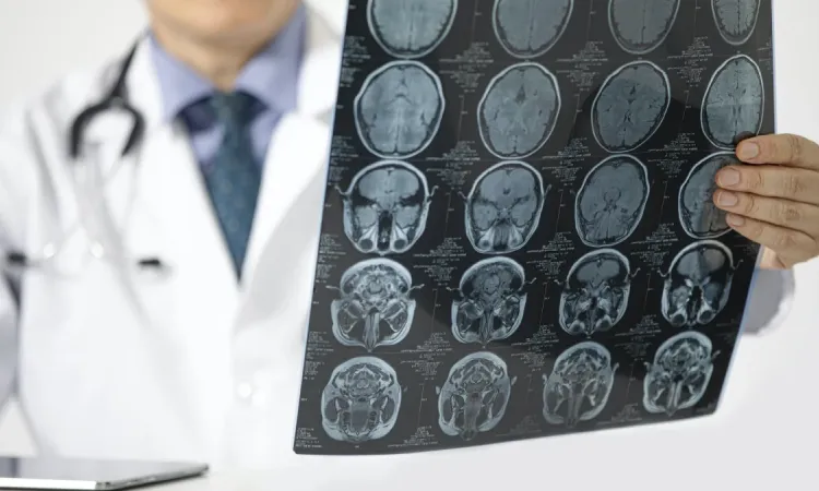 Ишемия головного мозга на МРТ