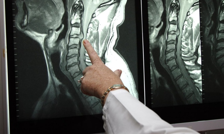 Снимок МРТ позвоночника в Царицыно