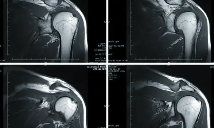 Снимок МРТ суставов