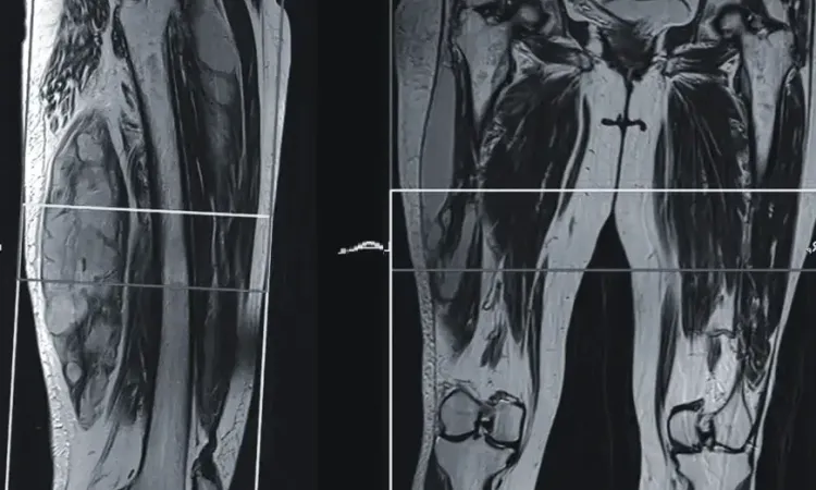 Снимок МРТ мягких тканей
