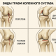 Травма коленного сустава
