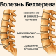 Признаки болезни Бехтерева на МРТ