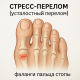 Усталостный перелом стопа