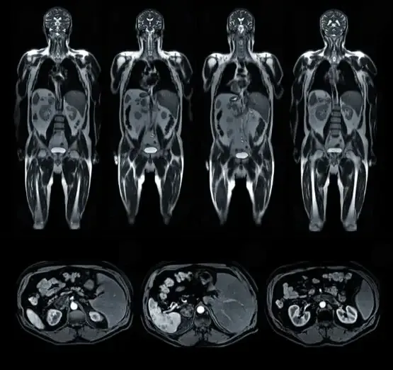 Снимок МРТ В Люблино